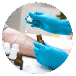 Allergy Testing