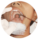 Biopsy (if required)