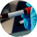 Complete Blood Count (CBC)